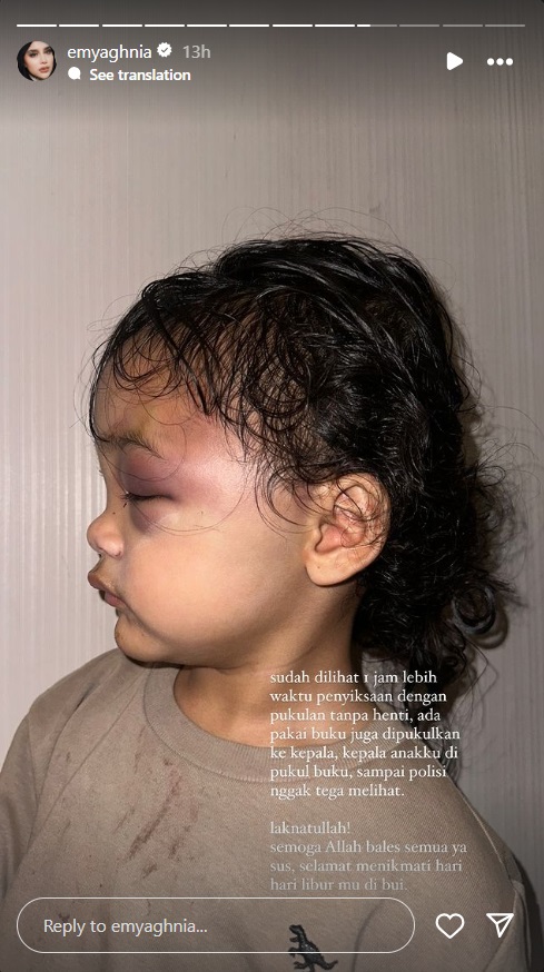 Aghnia Punjabi Ungkap Anaknya Dipukul Buku dan Diguyur Minyak Gosok oleh Pengasuh